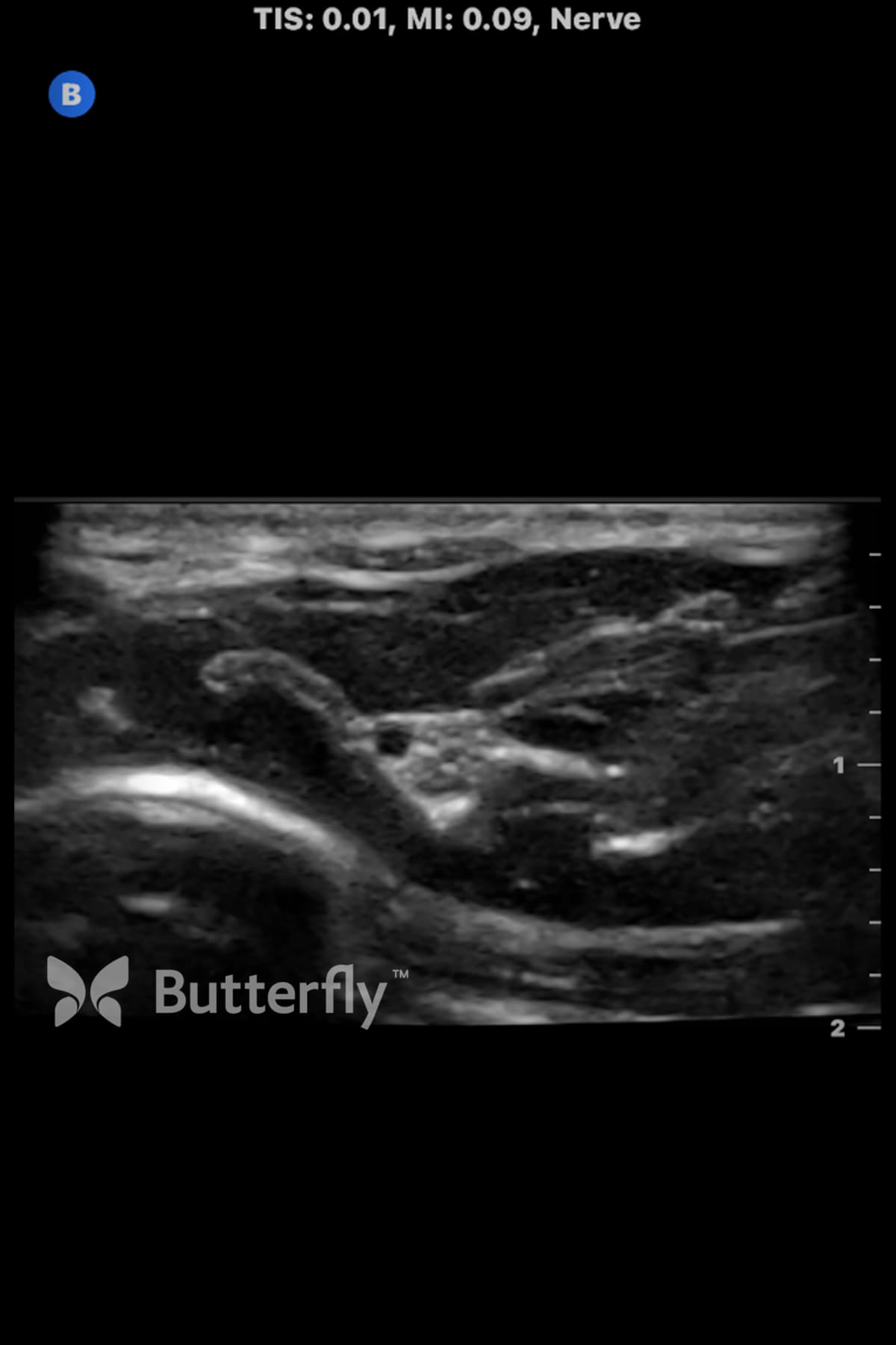 Interested in POCUS clinical images for Anesthesiology?